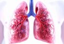 Gujarat sees steady rise in lung cancer cases, tobacco remains key risk factor